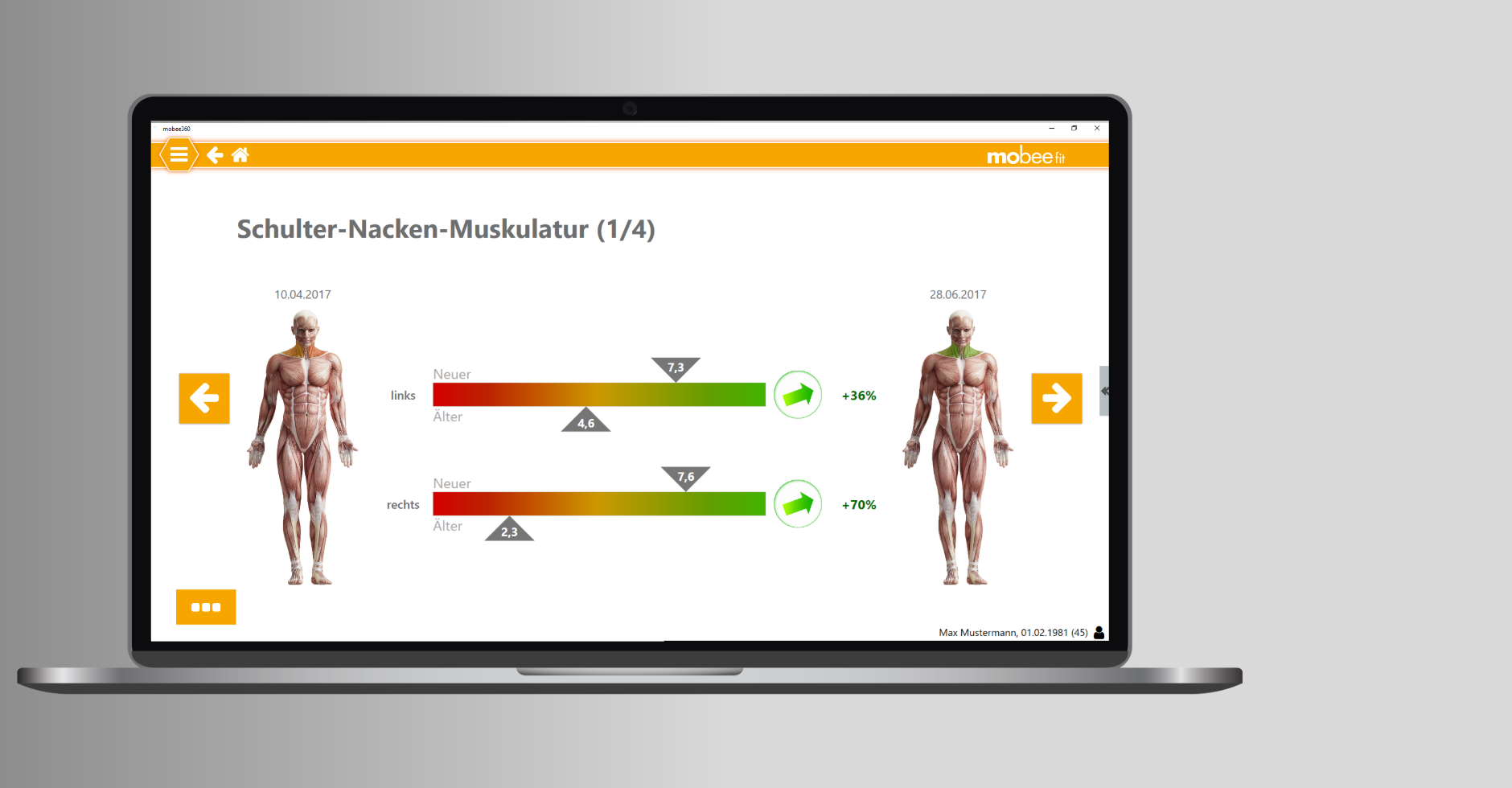 Screen Vergleich zweier Analysen