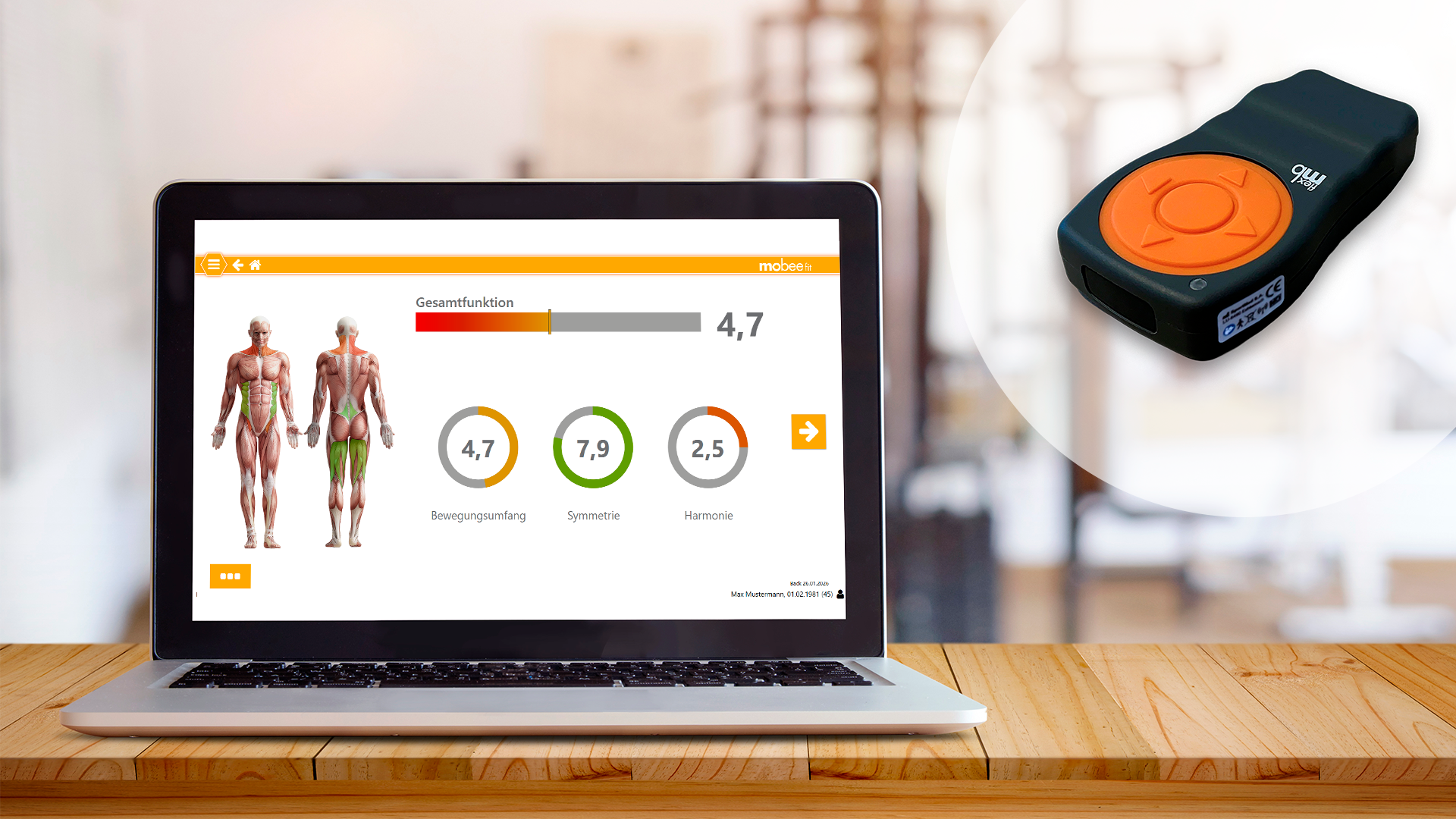 Laptop zeigt Ergebnis der digitalen Diagnostik und das Analysetool mobee fit.