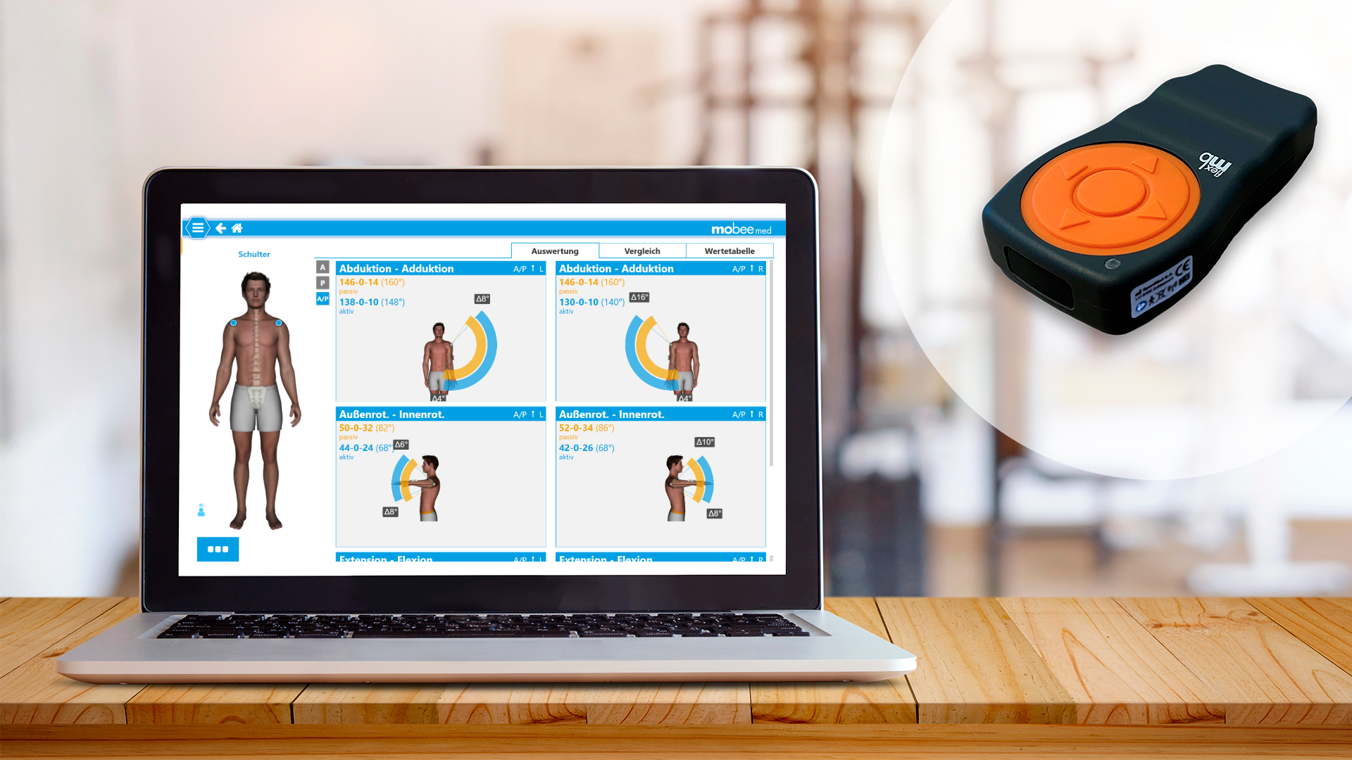 Laptop zeigt Ergebnis der digitalen Diagnostik und das Analysetool mobee med.
