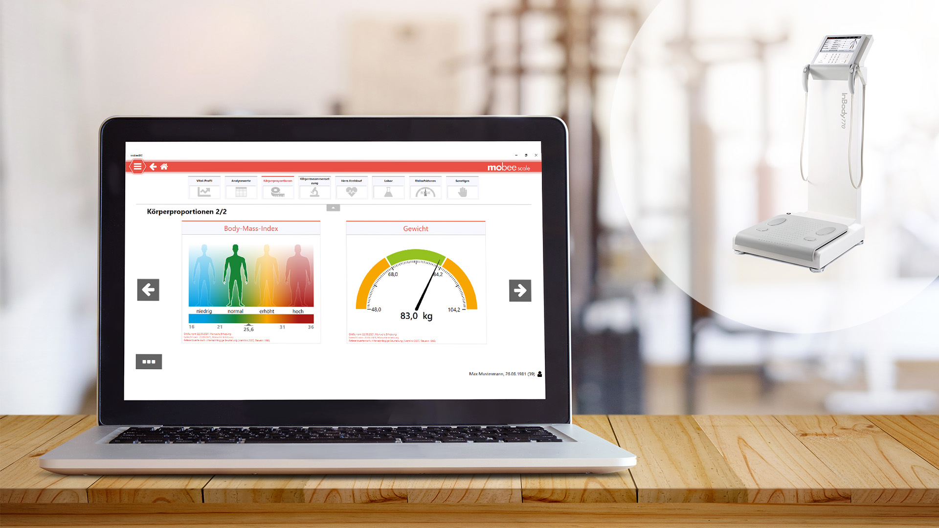 mobee scale Laptop