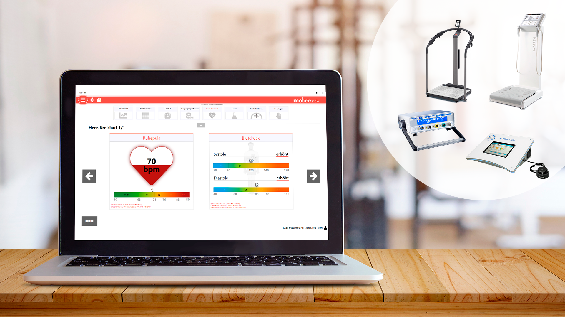 Laptop zeigt mobee scale - das mobee360 Modul zur Körperzusammensetzung mit Anbindung der BIA-Geräte von InBody, seca, BIACORPUS und FUTREX